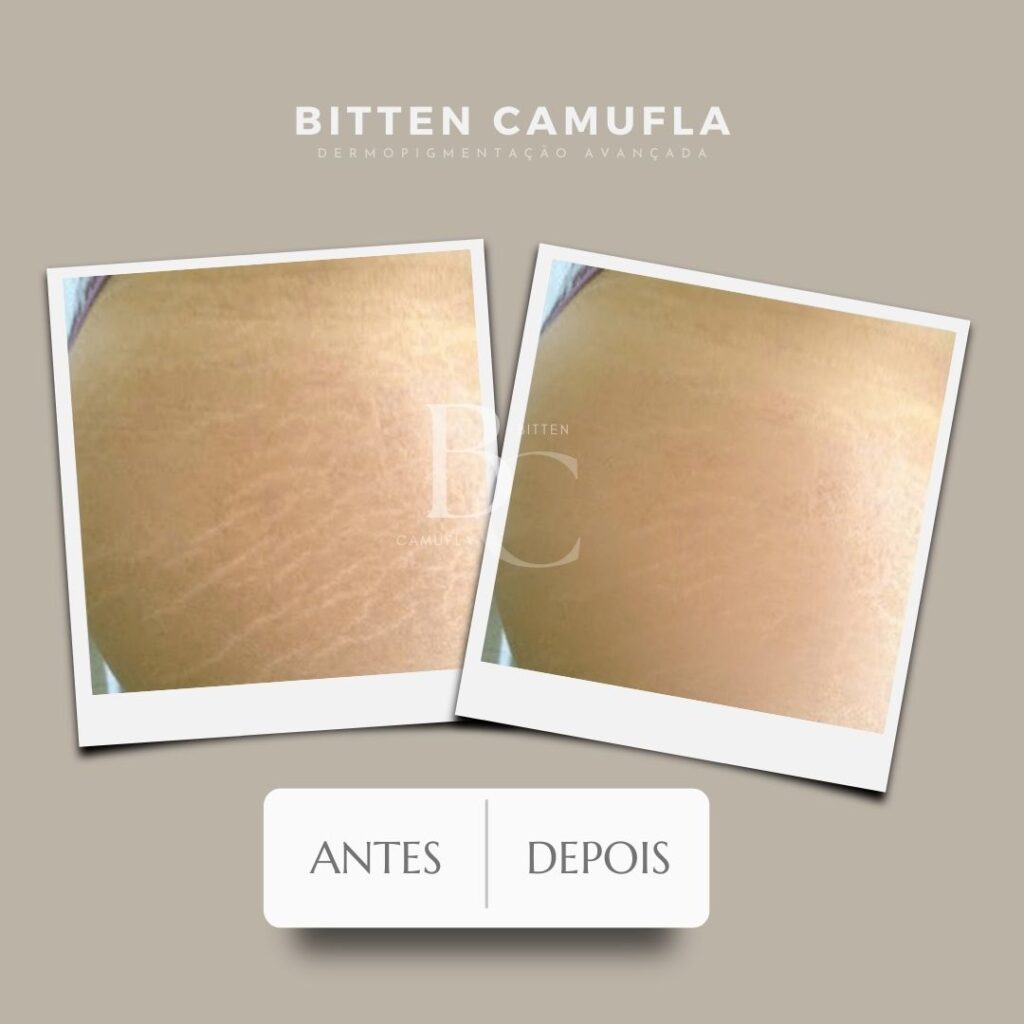 camuflagem para estrias