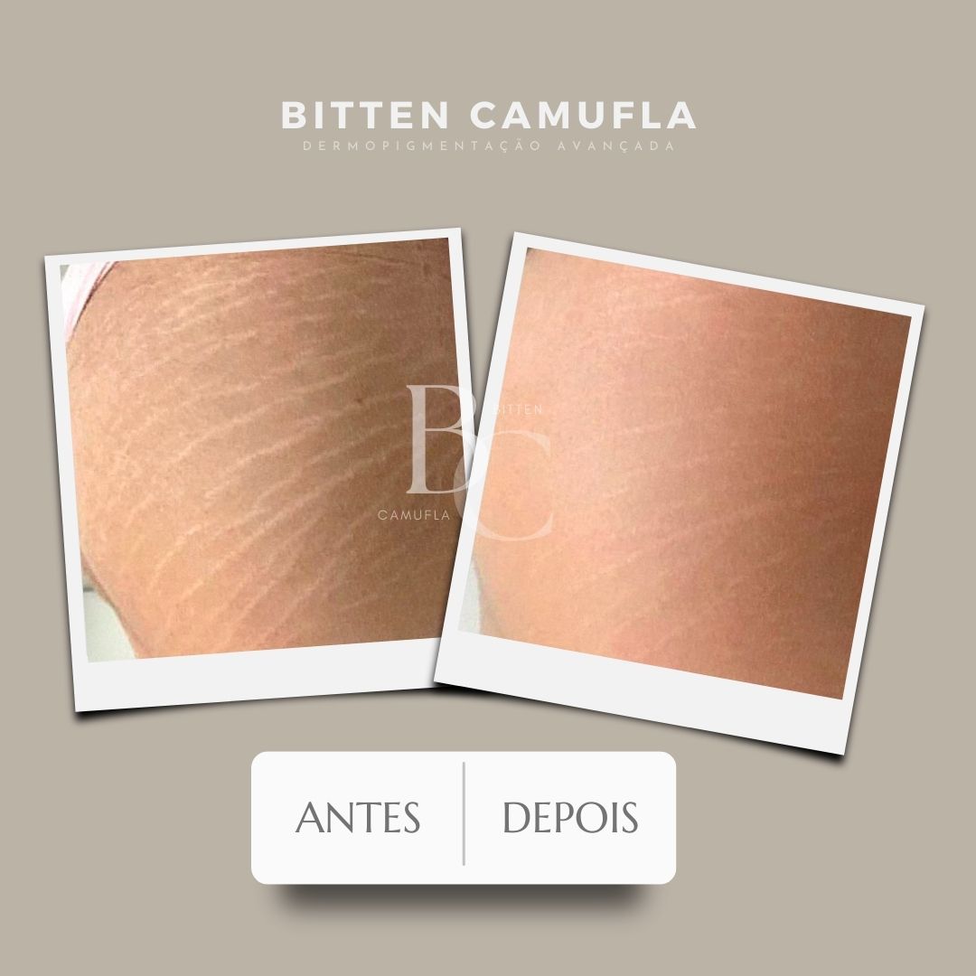 camuflagem estética